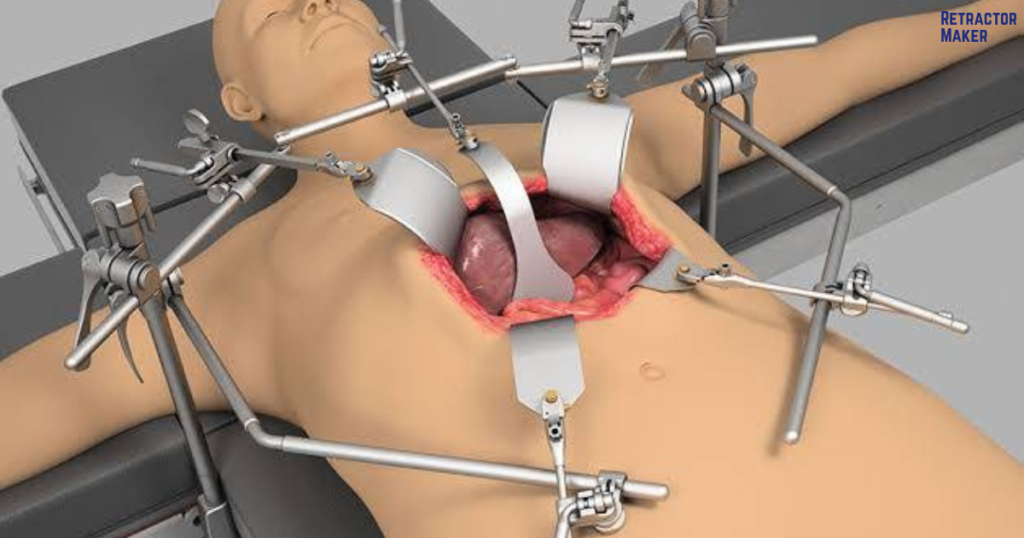 Dual-clamp Thompson Retractor System assembled with bilateral crossbars over an operating table
