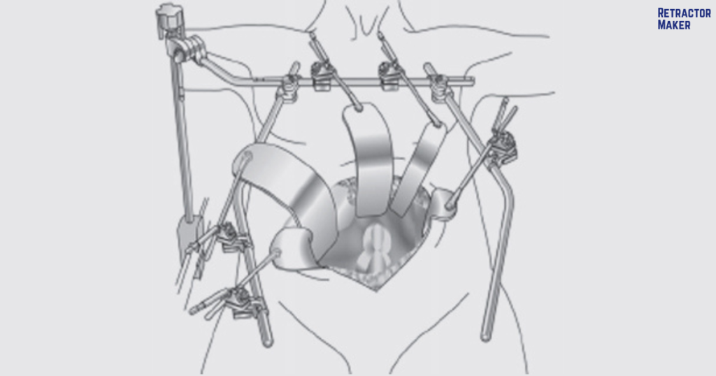 Technical diagram showing the structural architecture and frame components of a Thompson Retractor System