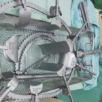 Bookwalter Retractor System Complete Assembly Setup